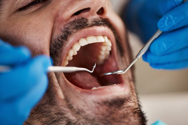 Best Emergency Broken Tooth Repair in Rden, WA
