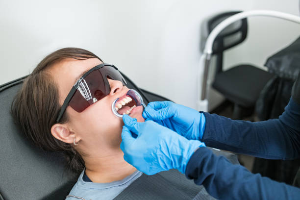 Best Emergency Tooth Extraction in Rden, WA