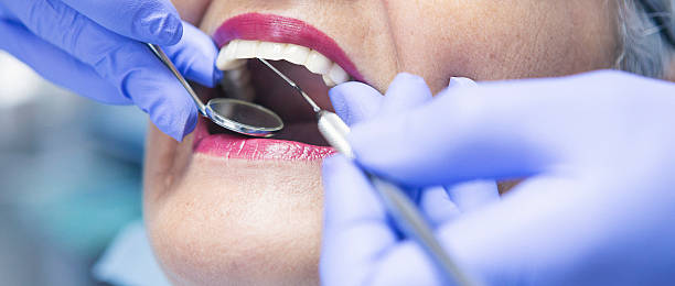 Best Emergency Tooth Extraction in Rden, WA